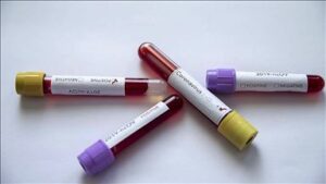 Şanlıurfa’da 4 sokak ile 33 bina karantinaya alındı