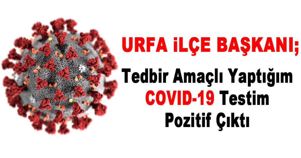 URFA İLÇE BAŞKANI: TEDBİR AMAÇLI YAPTIRDIĞIM COVİD-19 TESTİM POZİTİF ÇIKTI