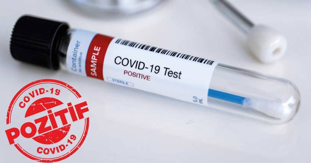 Urfalılar Dikkat! Bu 9 Belirti Varsa Korona Oldunuz Demektir