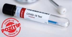 Urfalılar Dikkat! Bu 9 Belirti Varsa Korona Oldunuz Demektir