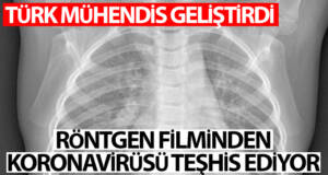 Türk mühendis, röntgen filmlerinden koronayı teşhis eden sistem geliştirdi