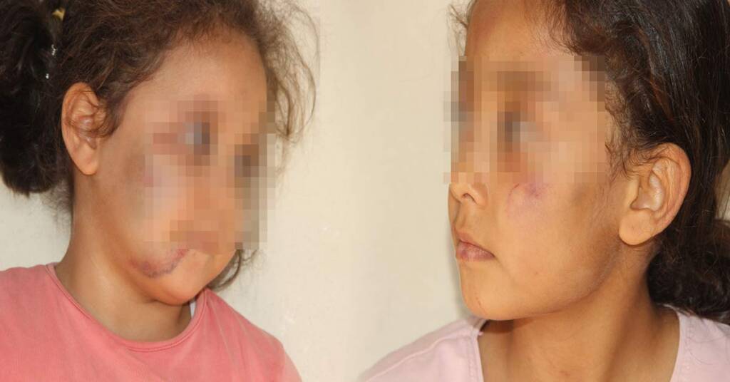 Şanlıurfa’da Çocuklarına işkence yapan baba eziyet etme suçundan yargılanacak