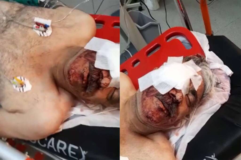 Şanlıurfa’da Arazi keşfinden dönen şahsa ikinci kez silahlı saldırı düzenlendi