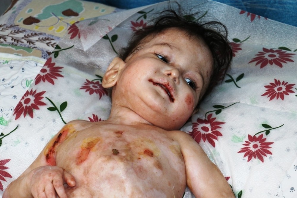 Yalçınkaya’dan hasta bebeğin ailesine gıda yardımı