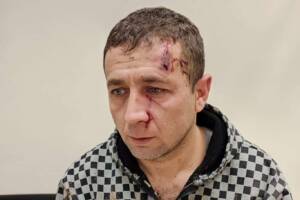 Şanlıurfa’da Büyükbaş hayvanın tekmelediği veterinerin burnu kırıldı