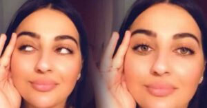 Urfalı Manolya, Estetik Ameliyatla Hayatını Kaybetti