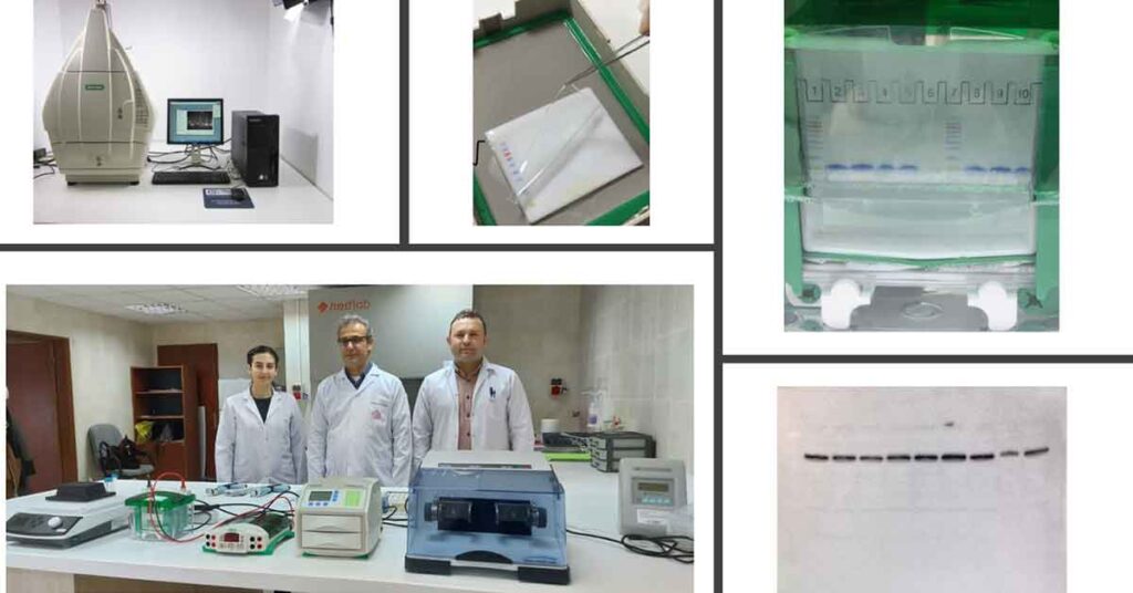 HRÜ’den Western Blot Yönteminin Kullanımı