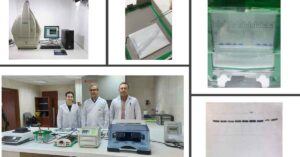 HRÜ’den Western Blot Yönteminin Kullanımı