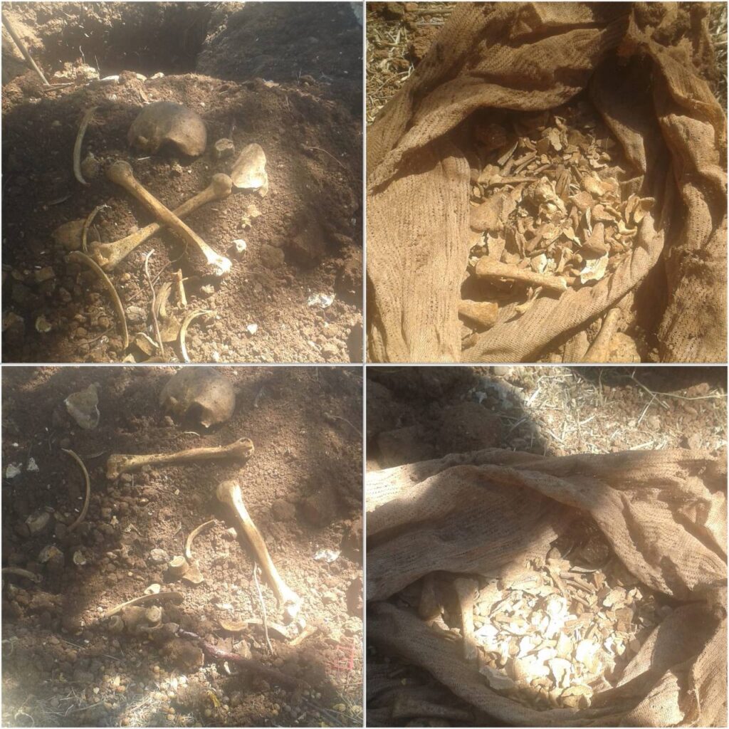 Şanlıurfa’da mezarlıklar bakımsız insan kemikleri mezardan çıkmış vaziyette