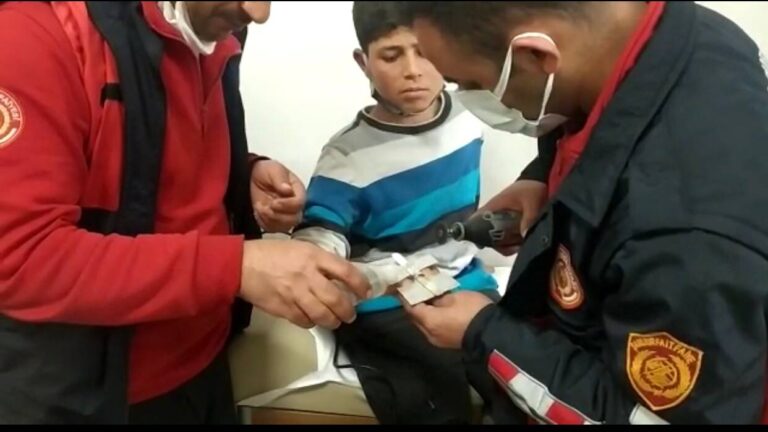 Şanlıurfa’da bir çocuğun parmağına yüzük sıkıştı