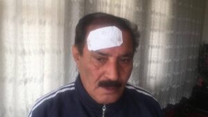 Şanlıurfa’da Kafasına çatıdan kasalar düştü!