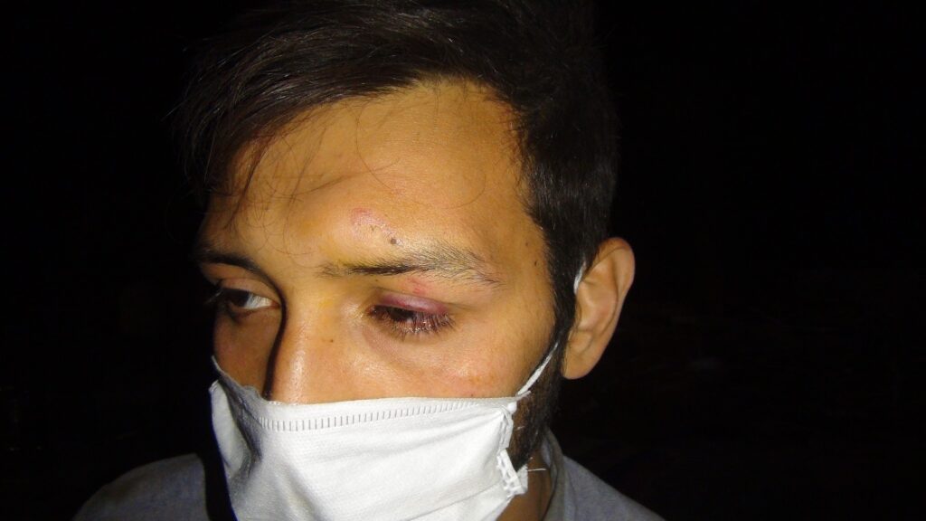 Şanlıurfa’da Hırsızlar görevliyi hortumla döverek bayılttı