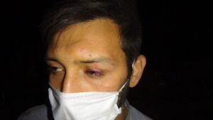 Şanlıurfa’da Hırsızlar görevliyi hortumla döverek bayılttı