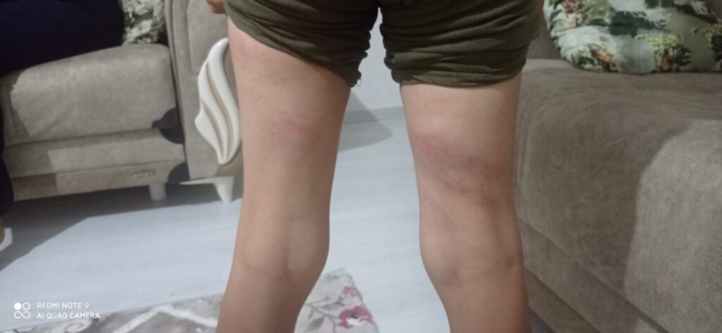 Halfeti’de 11 yaşındaki çocuğa dehşeti yaşattı: Elektrik kablolu işkence!