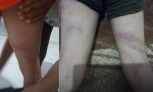 Şanlıurfa’da küçük çocuğa işkence iddiası