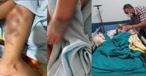 Urfa’da sağlık skandalı: Minik Gamze’nin acı dolu 13 günü