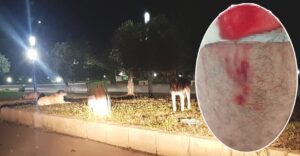 Şanlıurfa’da 3 kişi köpeklerin saldırısına uğradı