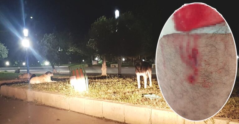 Şanlıurfa’da 3 kişi köpeklerin saldırısına uğradı