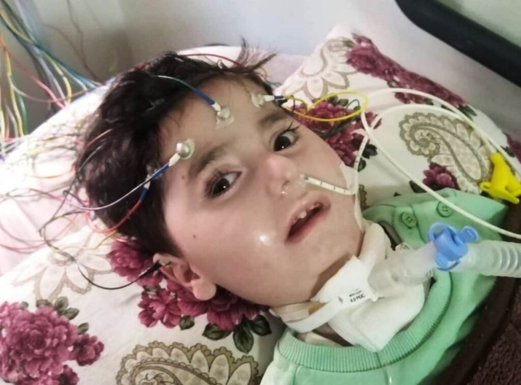 Halfeti’de SMA hastası Abdullah yaşam mücadelesi veriyor