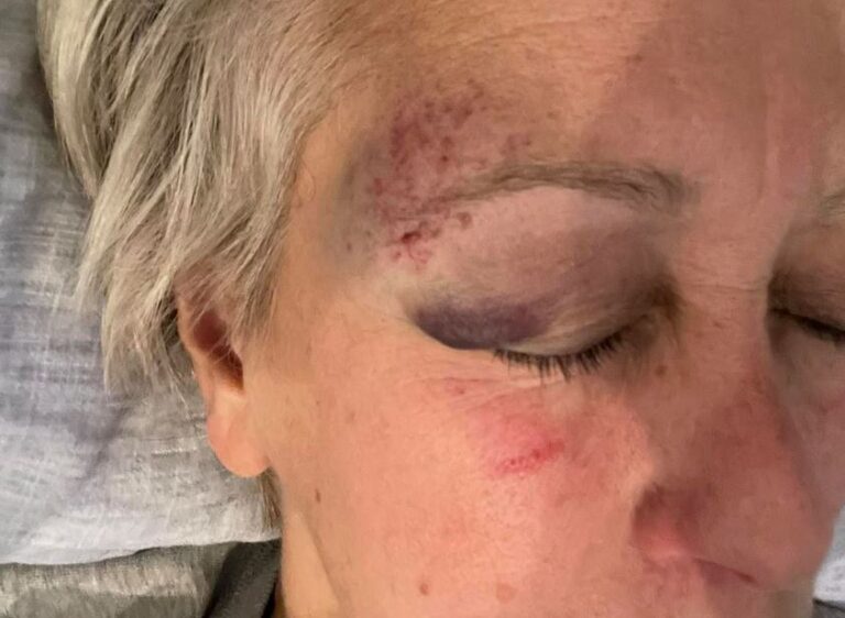 Şanlıurfa’da bulunan Klaus Schmidt’in eşinden komşusu hakkında hem darp hem gasp iddiası!