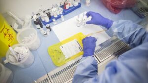 Türkiye’de yılda 7 milyon kişiye ücretsiz kanser taraması yapılıyor