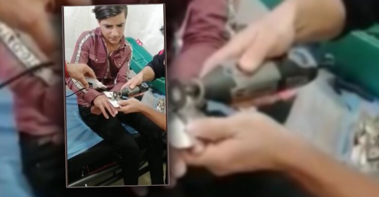 Şanlıurfa’da Yüzüğü parmağına sıkışınca yardımına itfaiye yetişti