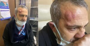 Şanlıurfa’da Hemşireye darp edenlerden 2’si tutuklandı