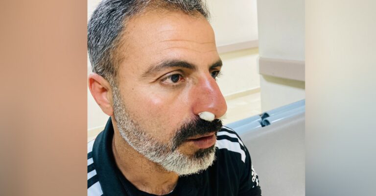 Karaköprü Belediyespor personeline saldırı