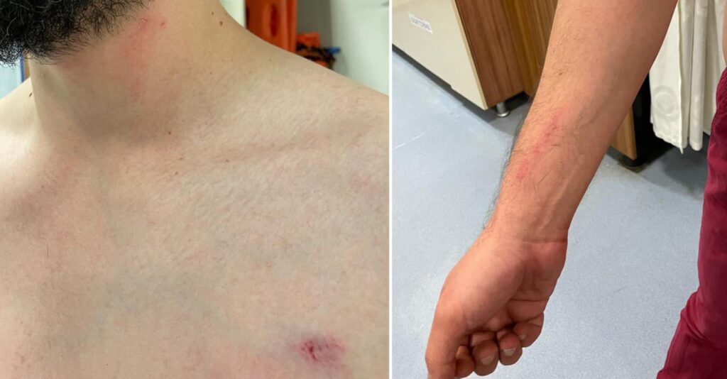 Şanlıurfa’da doktorun darp edilmesine tepki!