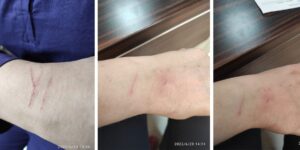 Eyyübiye’de sağlık çalışanları şiddete uğradı!