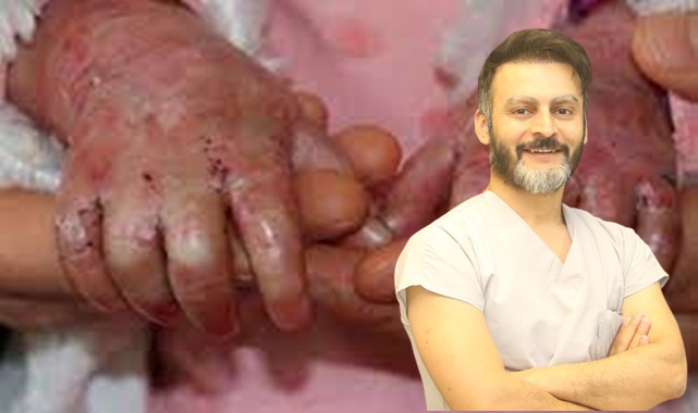 Dünyada sayılı doktorun yaptığı operasyon, artık Şanlıurfa’da yapılıyor