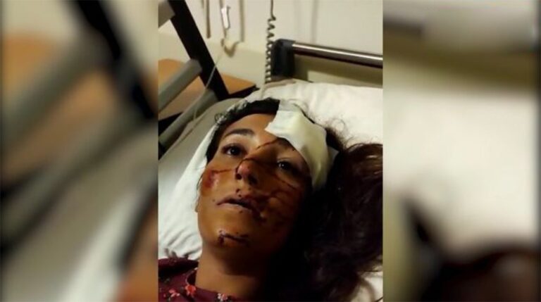 Şanlıurfa’da takip edilen kadına araç çarptı