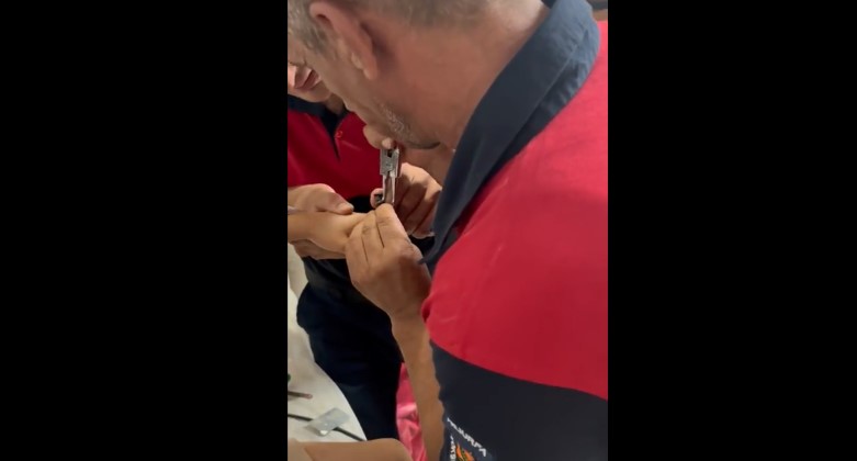 Şanlıurfalı çocuğun parmağı musluk aynasına sıkıştı!