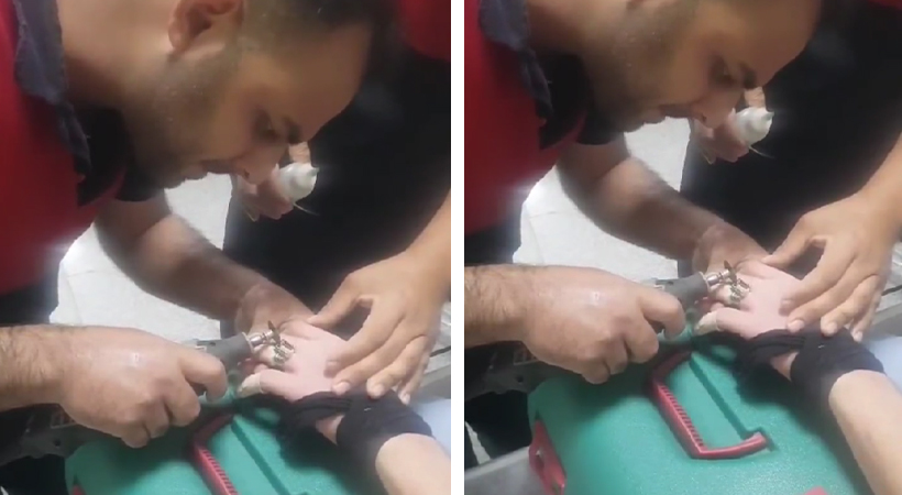 Şanlıurfa’da bir kişinin parmağına sıkışan yüzüğü itfaiye çıkardı