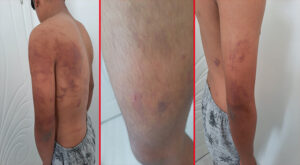 Şanlıurfa’da babası ve amcası tarafından 15 yaşındaki çocuğa işkence iddiası