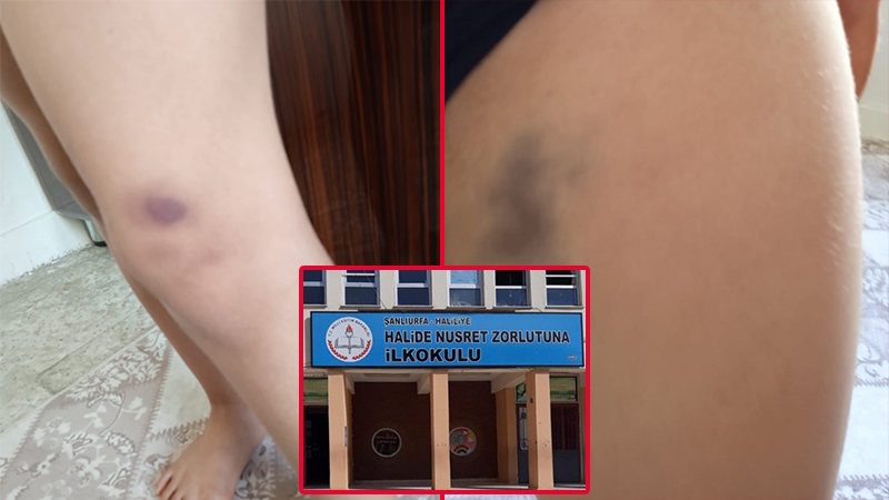 Şanlıurfa’da ilkokulda oğlu darp edilen anne şikayetçi oldu