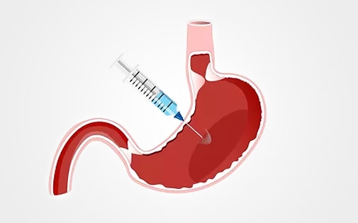 Mide Botoksu Nedir, Faydaları, Zararları ve Nasıl Uygulanır?