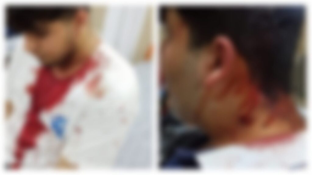 Şanlıurfa’da sopalı kavga: 4 yaralı