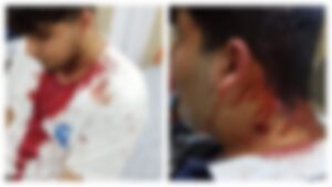 Şanlıurfa’da sopalı kavga: 4 yaralı