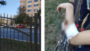 Şanlıurfa’da demir korkuluklara kolu saplanan genç itfaiye ekiplerince kurtarıldı