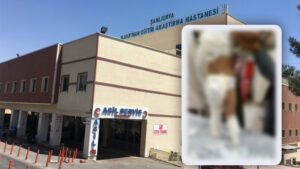 Şanlıurfa’da 3 yaşındaki kız çocuğu kaynar suyla yandı