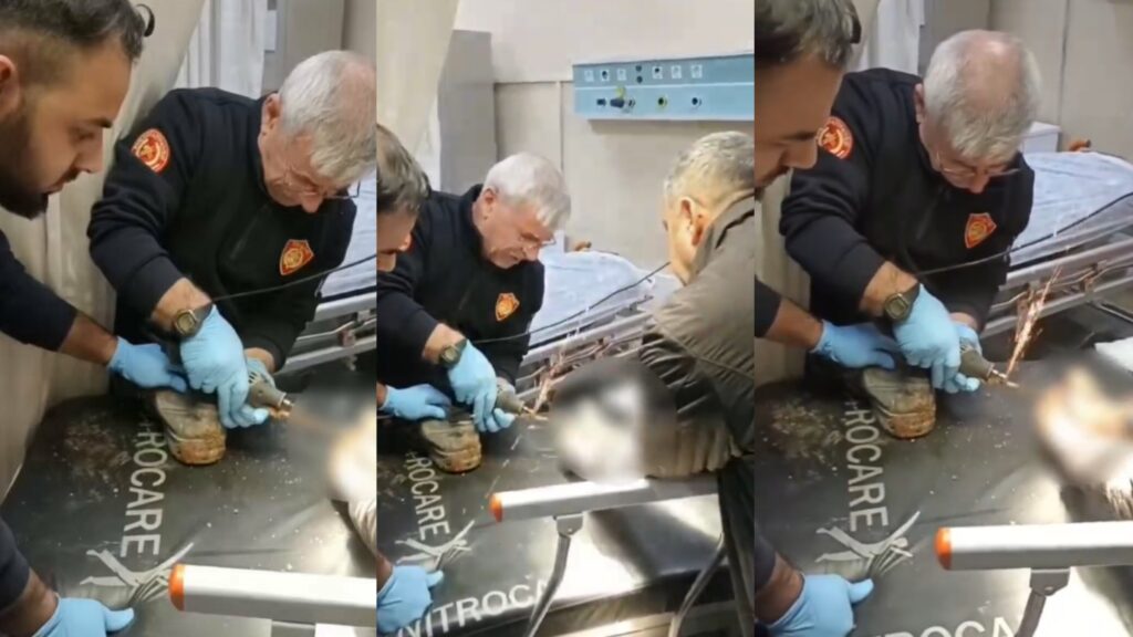 Şanlıurfa’da itfaiye işçinin ayağını kurtardı